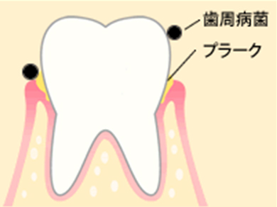 進行①