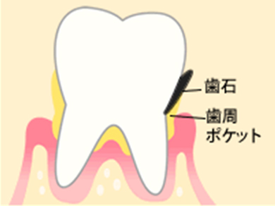 進行②